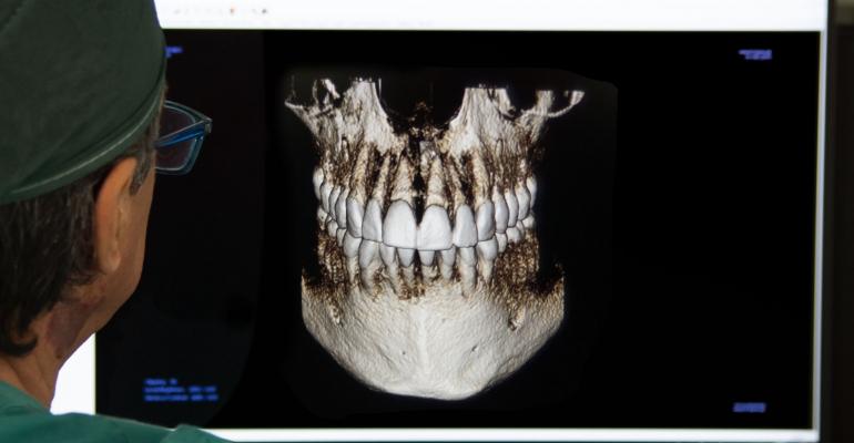 Mandibular regeneration after immediate load dental implant in a periodontitis patient 